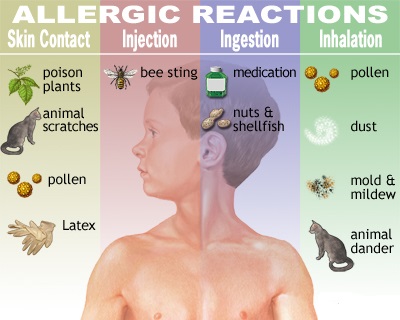 allergic reaction allergy body reactions allergens routes skin enter four