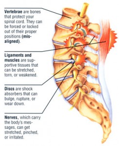 back pain-map – Dr Rajiv Desai