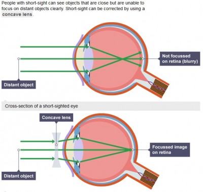 Does autorefractor detect astigmatism? – Latam Optical